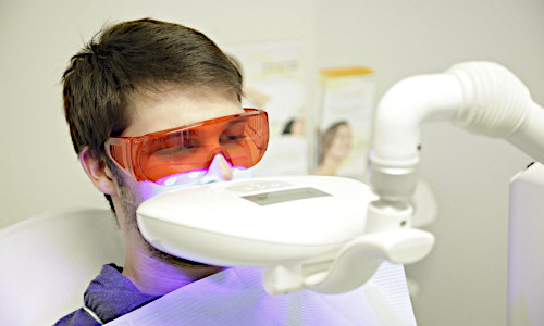 Осветление зубов стоматологической клиники